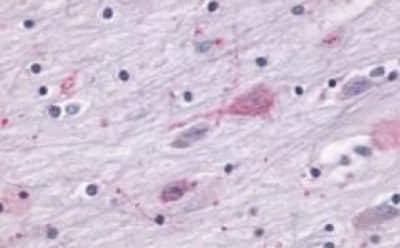 Immunohistochemistry: Melatonin R1A/MT1/MTNR1A Antibody [NBP3-14400]
